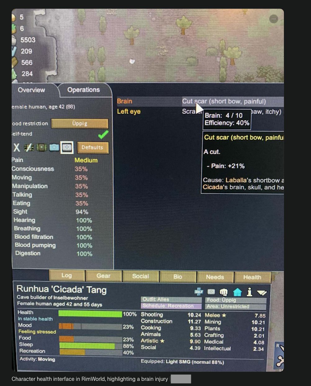 Character health interface in RimWorld, highlighting a brain injury